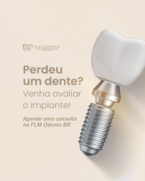 Implante dentário